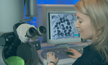 Partes del microscopio electrónico y sus funciones