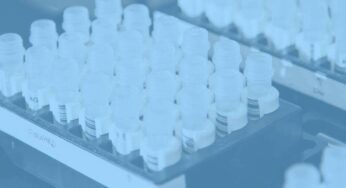 ¿Cómo transportar muestras biológicas de laboratorio?