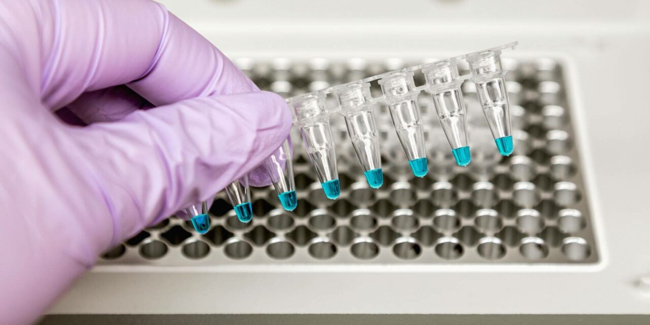 Importancia de los Equipos de PCR en la Investigación Biomédica